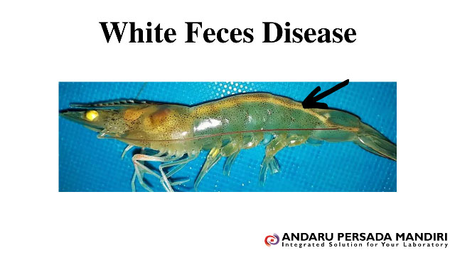 ilustrasi gambar White Feces Disease